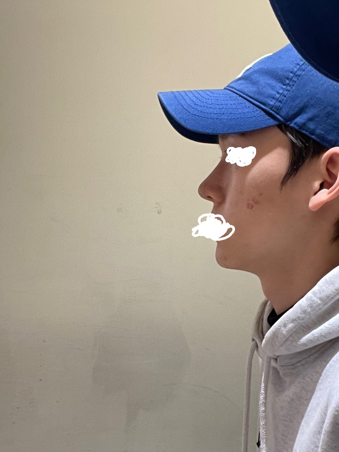 수술후기이미지