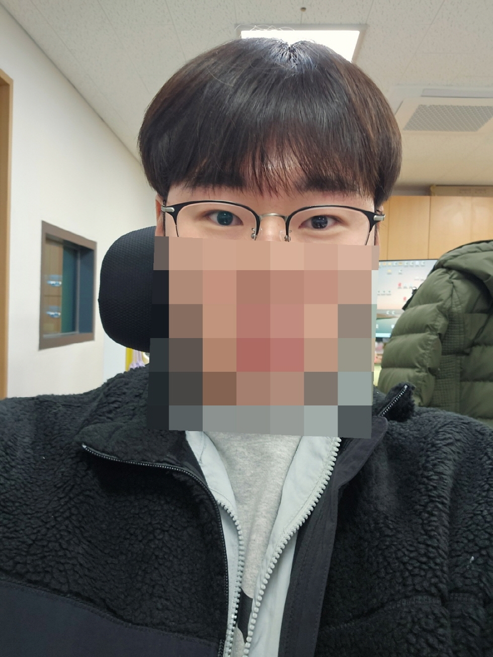 수술후기이미지