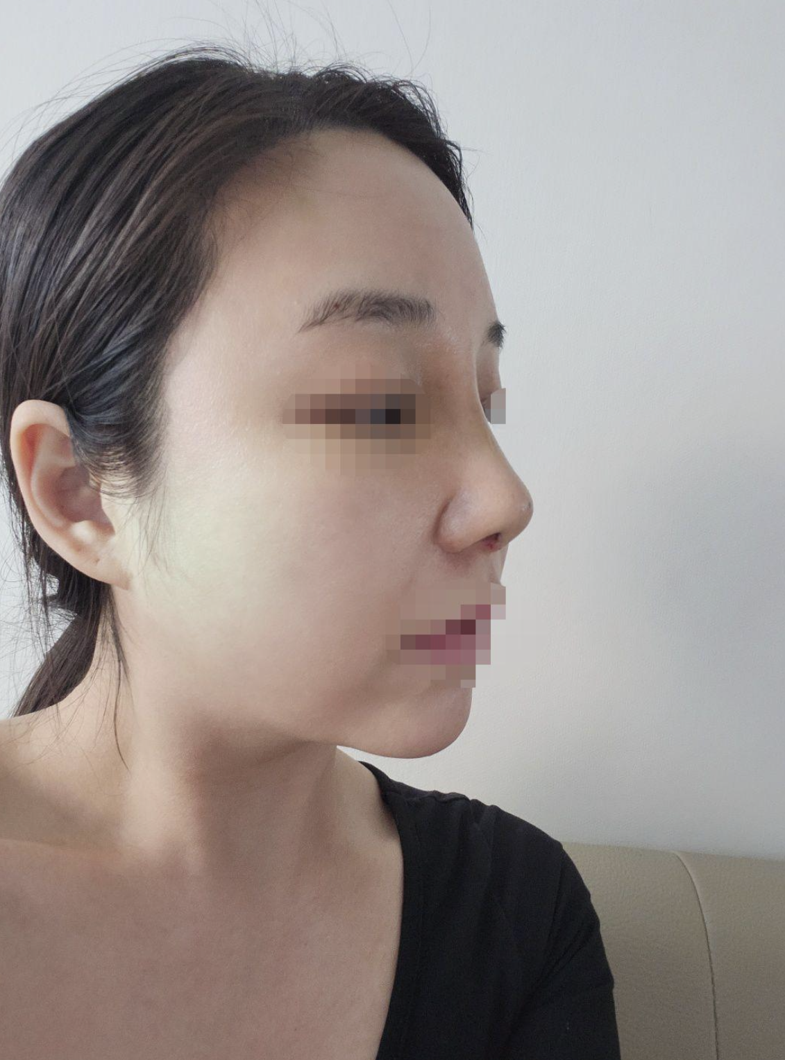 수술후기이미지