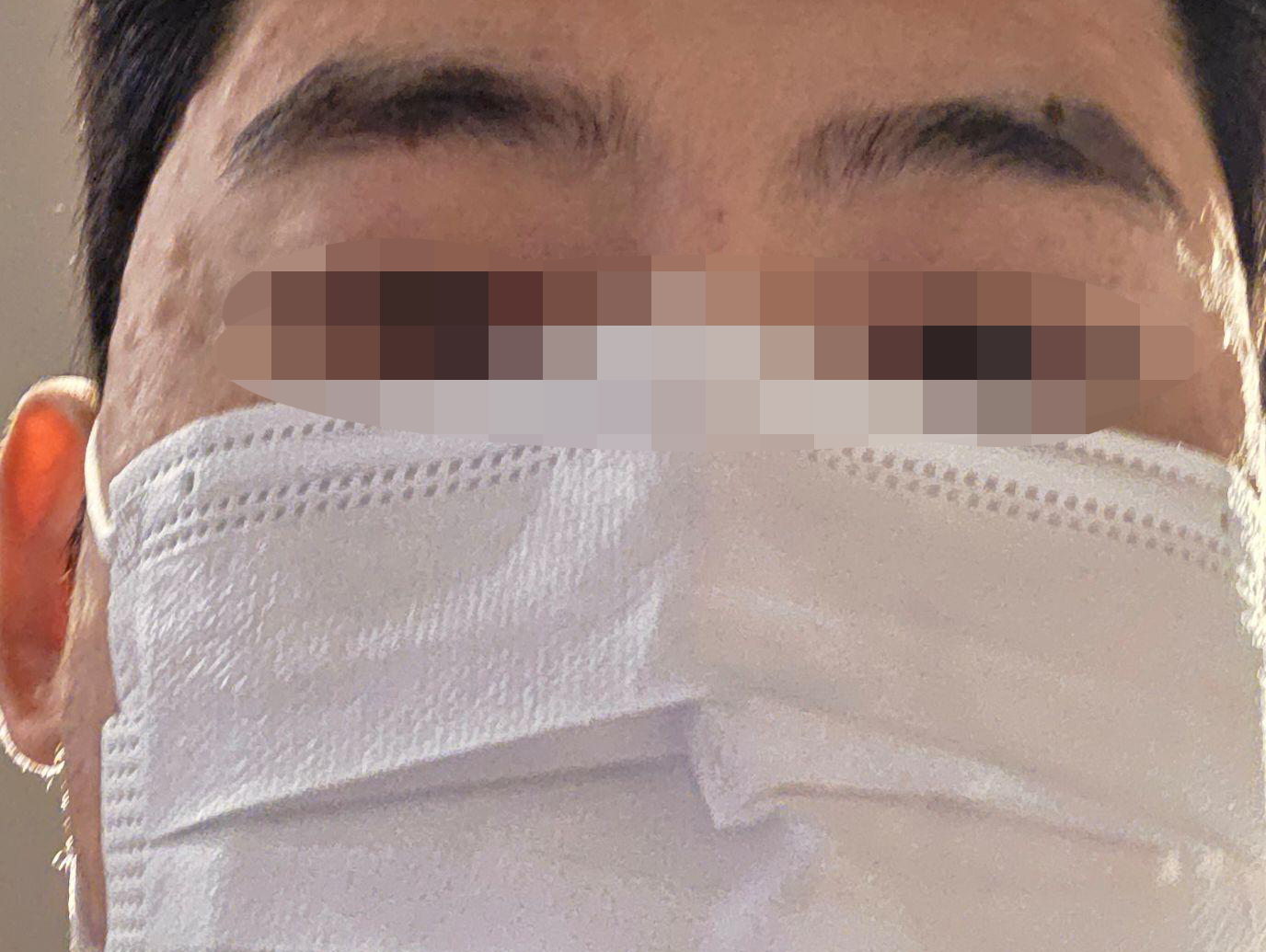 수술후기이미지