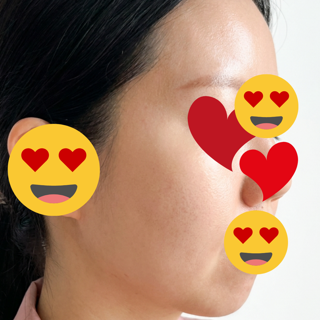 수술후기이미지