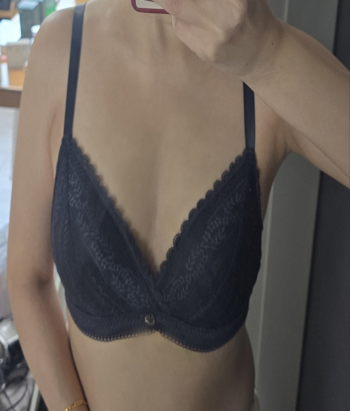 수술후기이미지