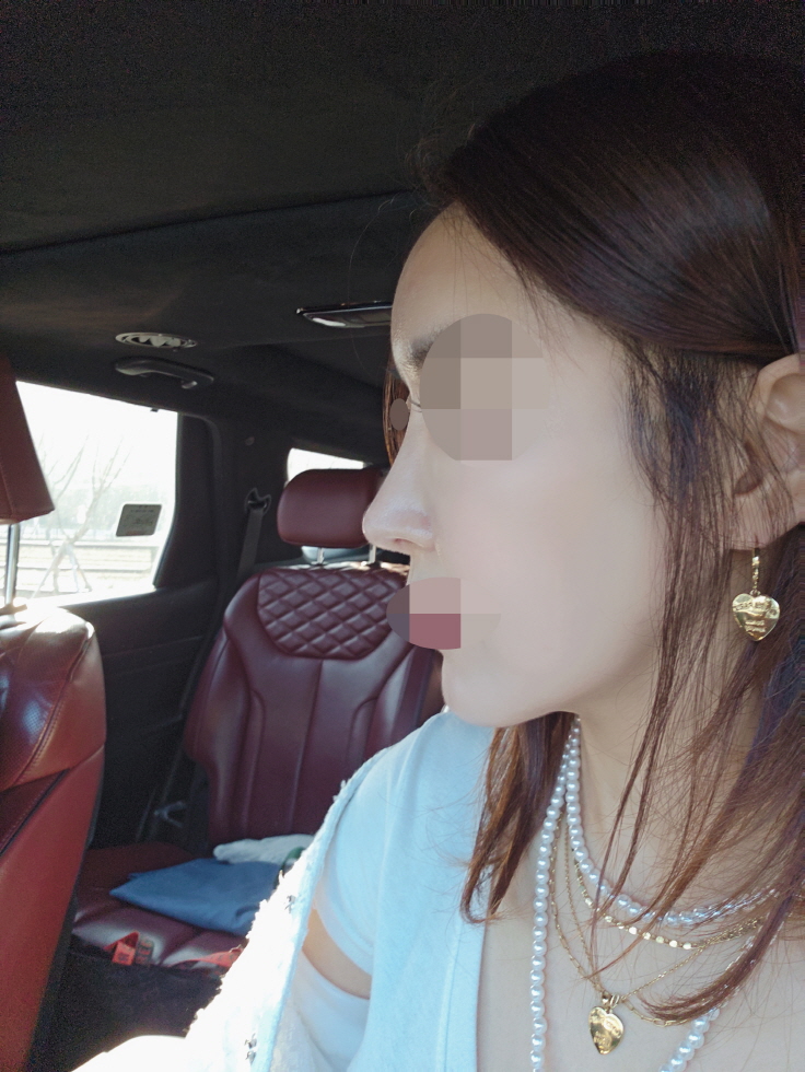 수술후기이미지