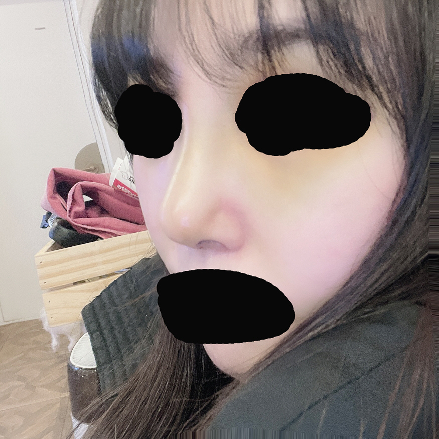 수술후기이미지