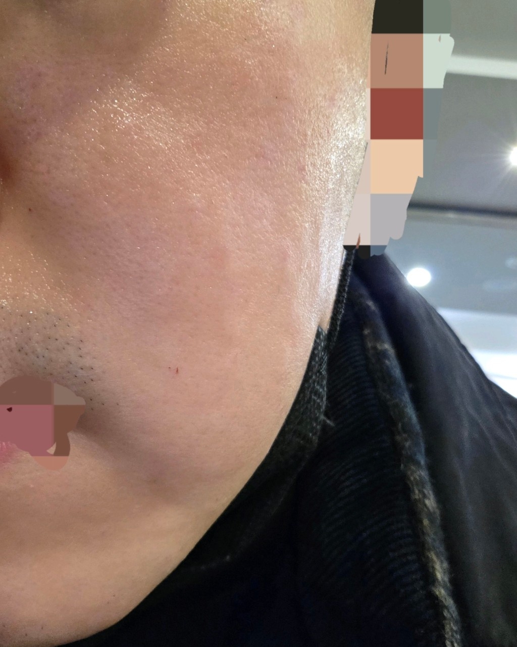 수술후기이미지