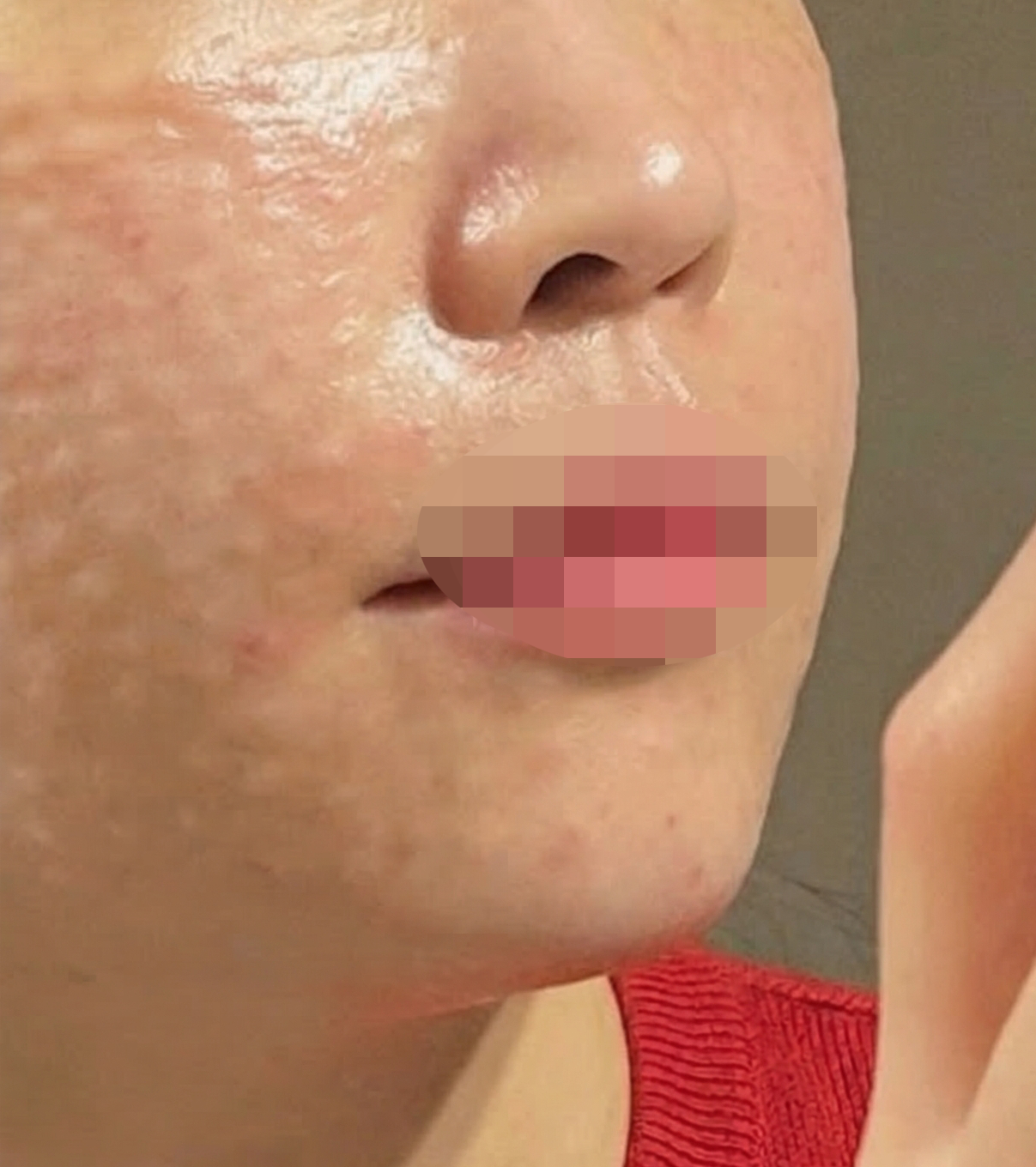 수술후기이미지