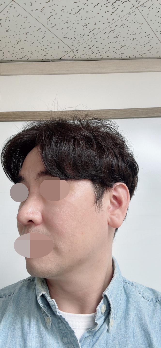 수술후기이미지