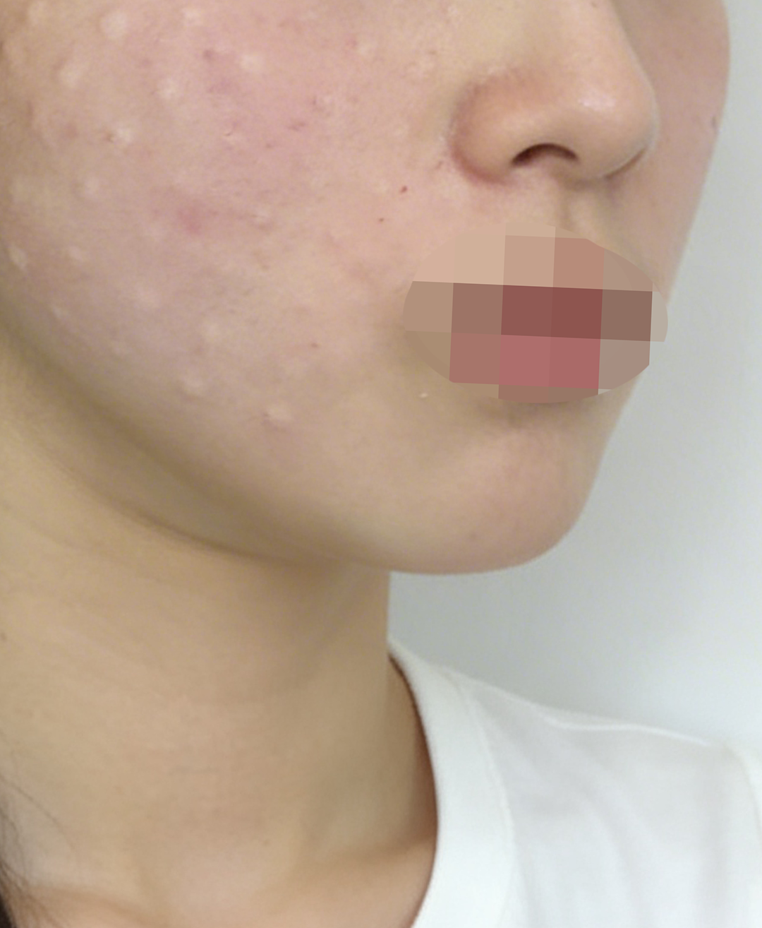 수술후기이미지