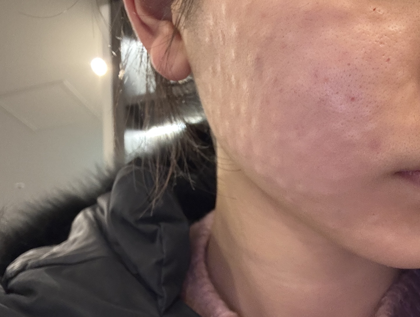 수술후기이미지