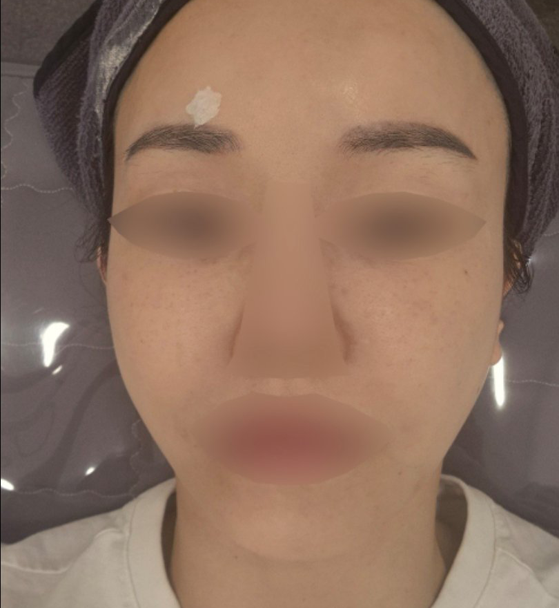 수술후기이미지