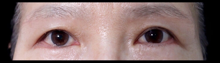 수술후기이미지