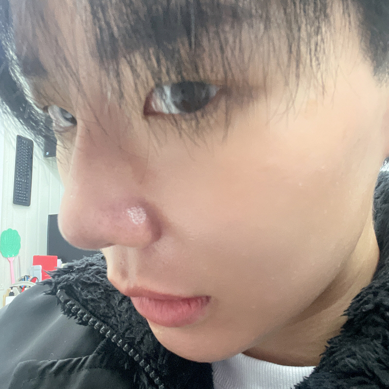 수술후기이미지