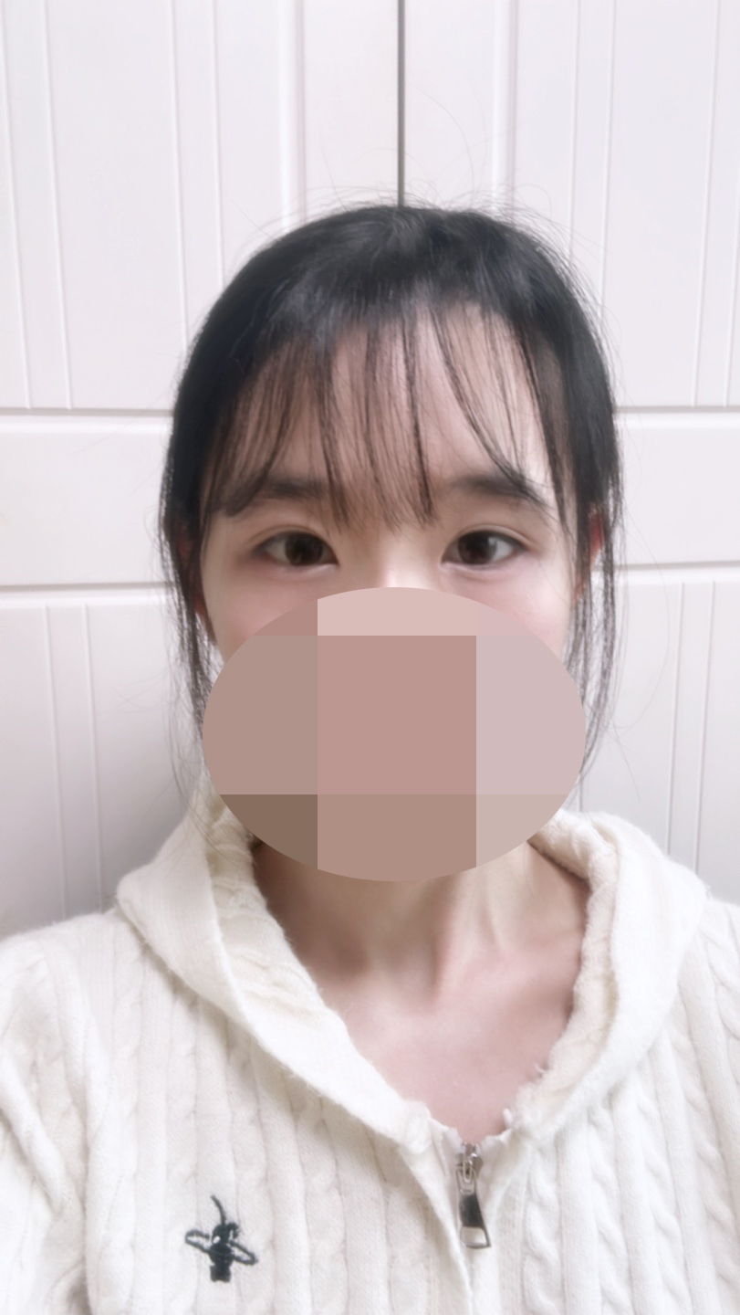 수술후기이미지