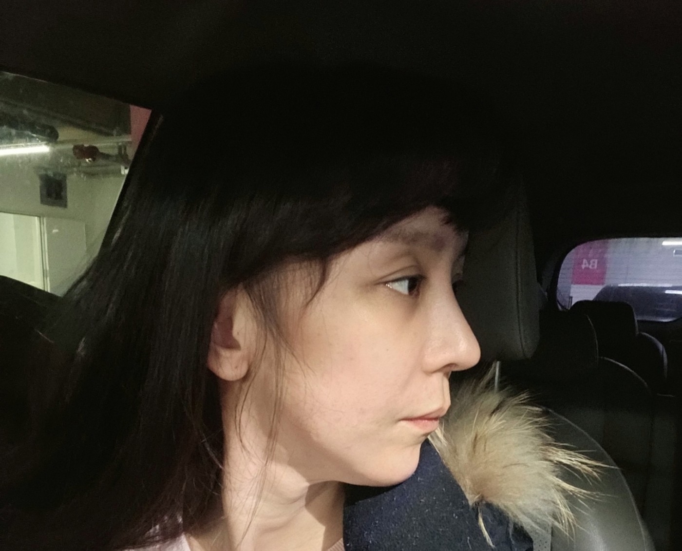 수술후기이미지