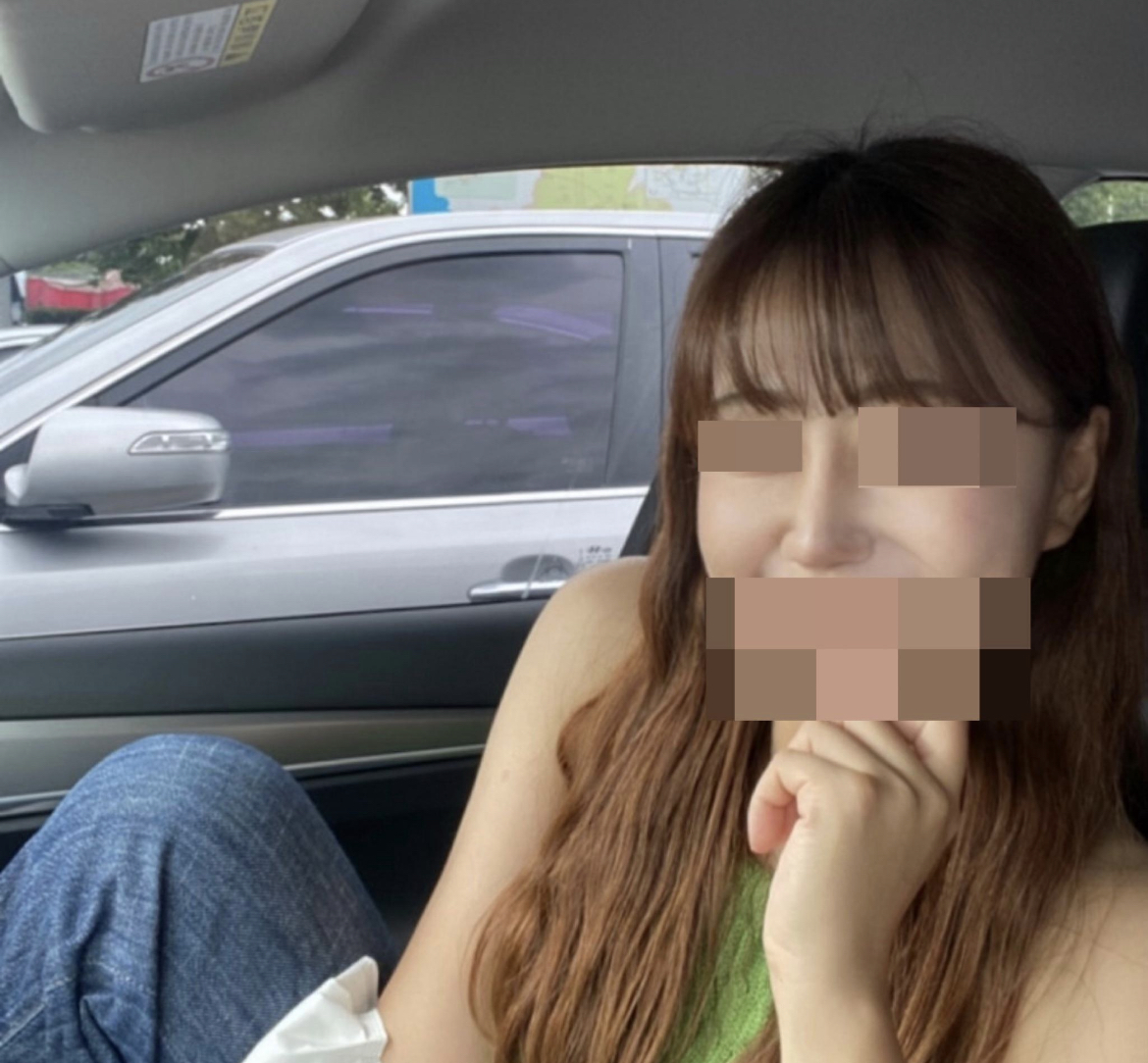 수술후기이미지