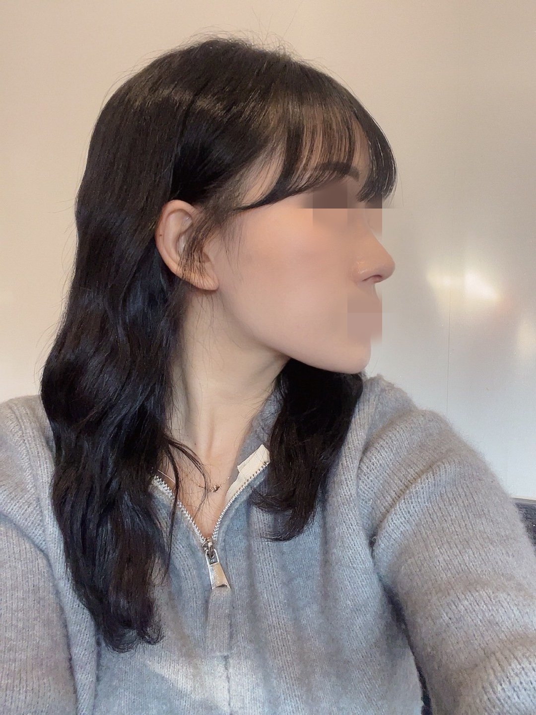 수술후기이미지