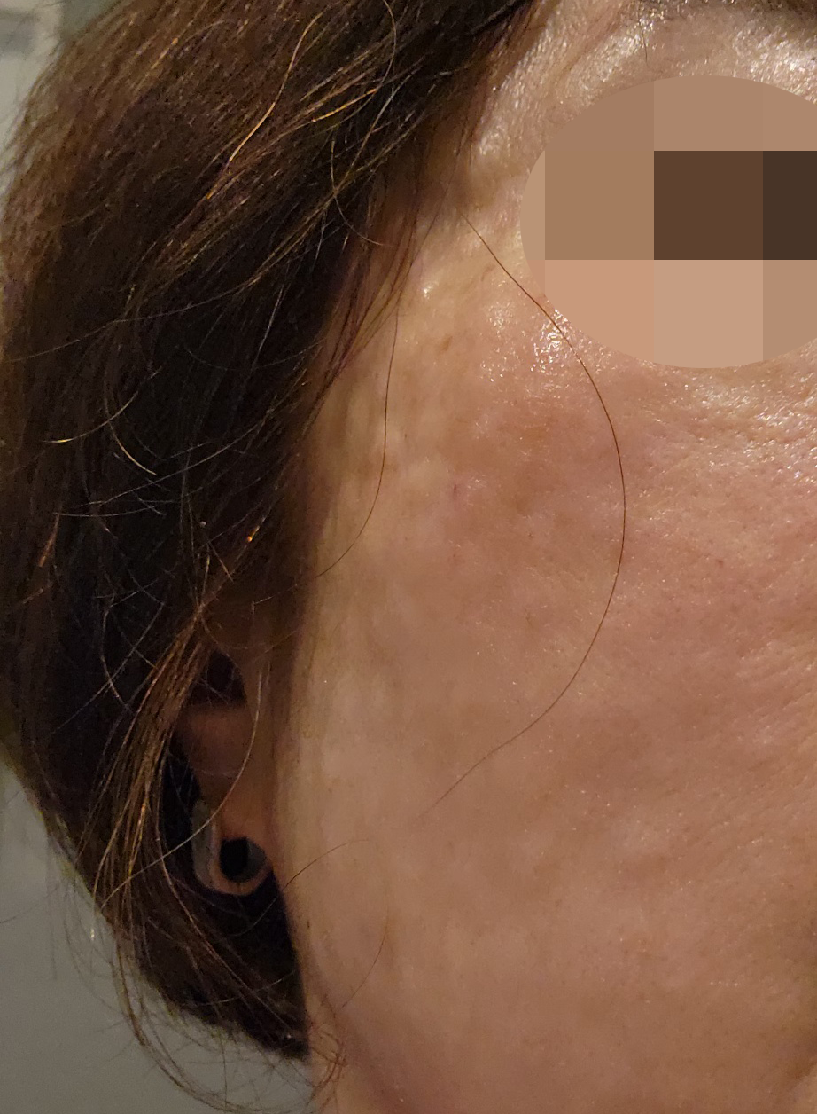 수술후기이미지