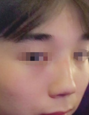 수술후기이미지