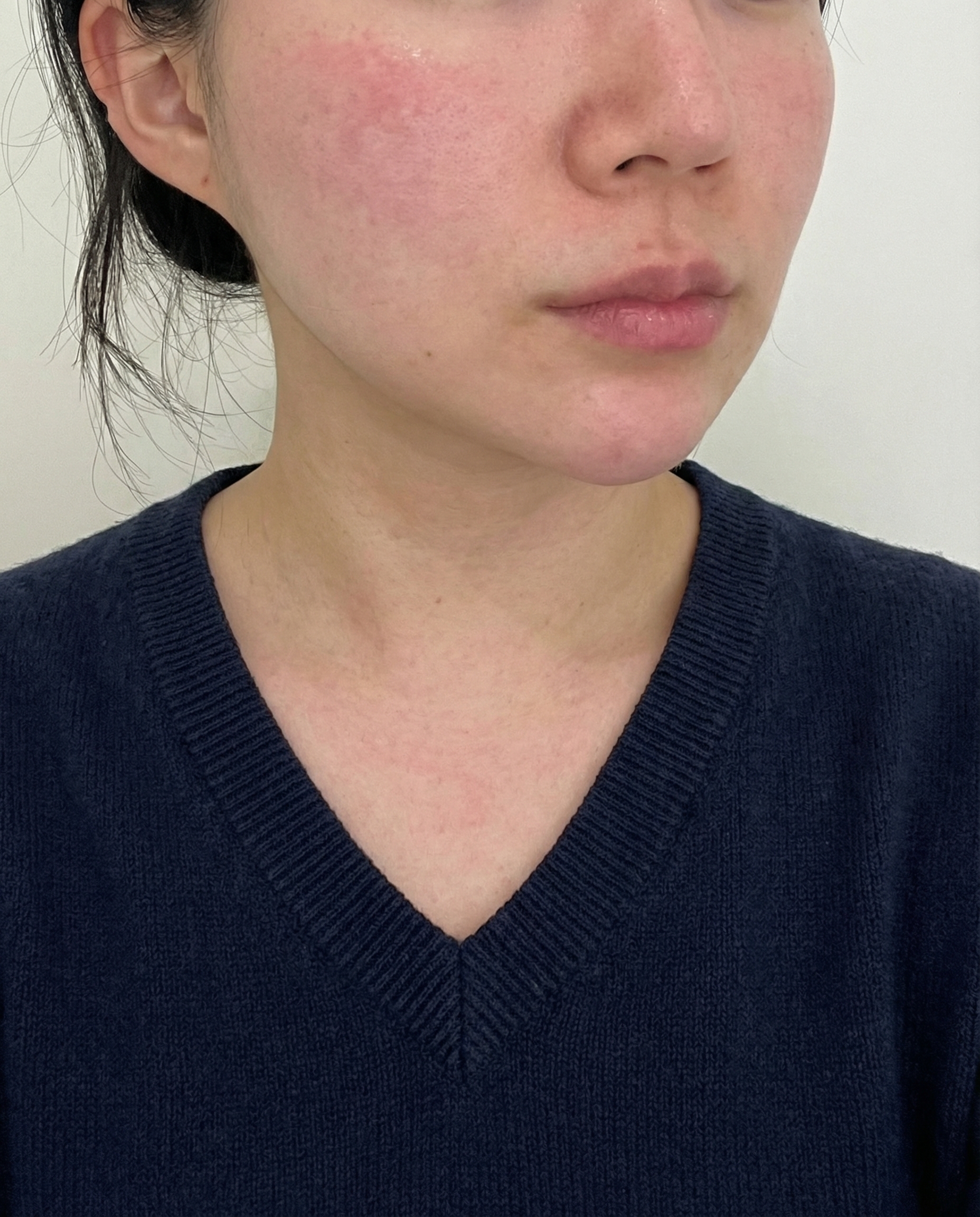 수술후기이미지