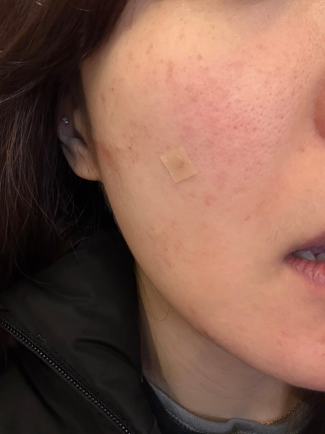 수술후기이미지