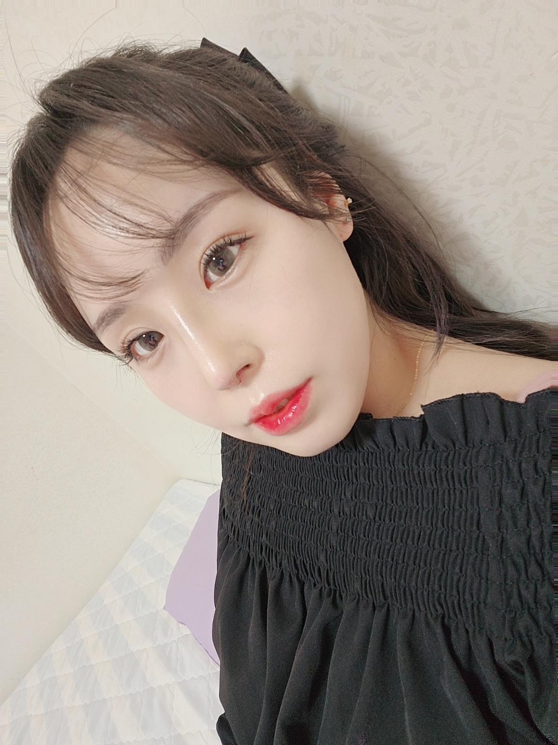 수술후기이미지