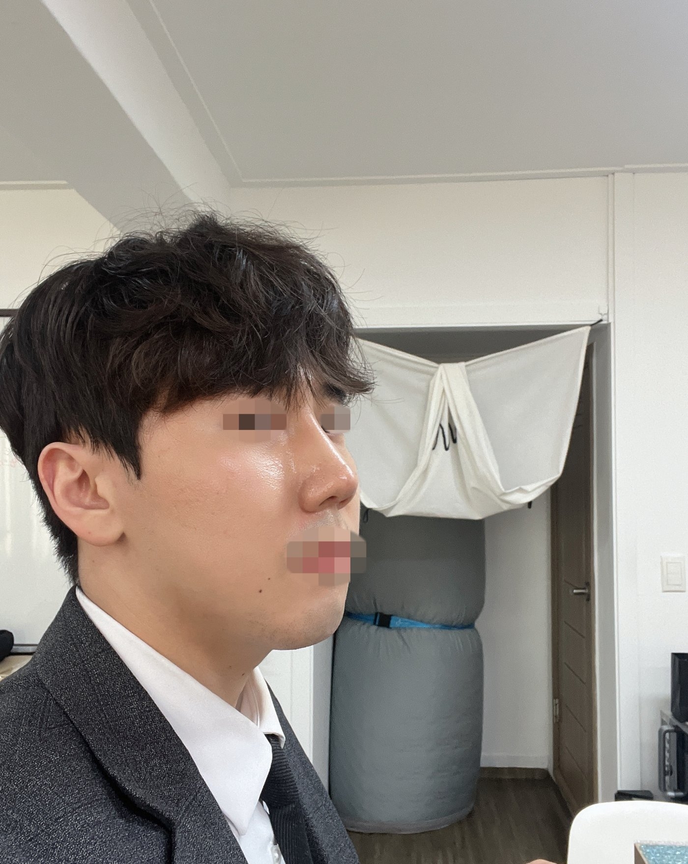 수술후기이미지