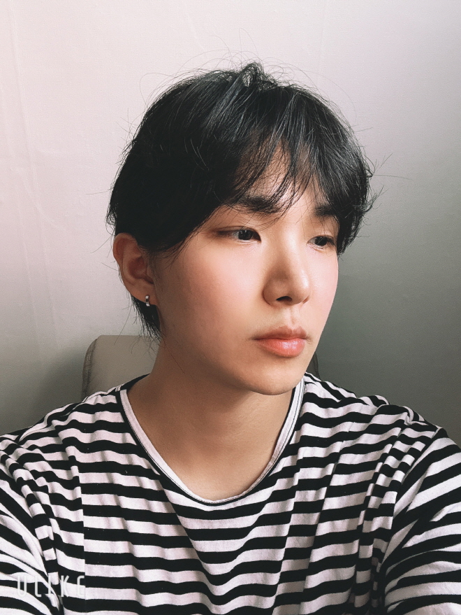 수술후기이미지