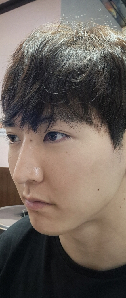 수술후기이미지