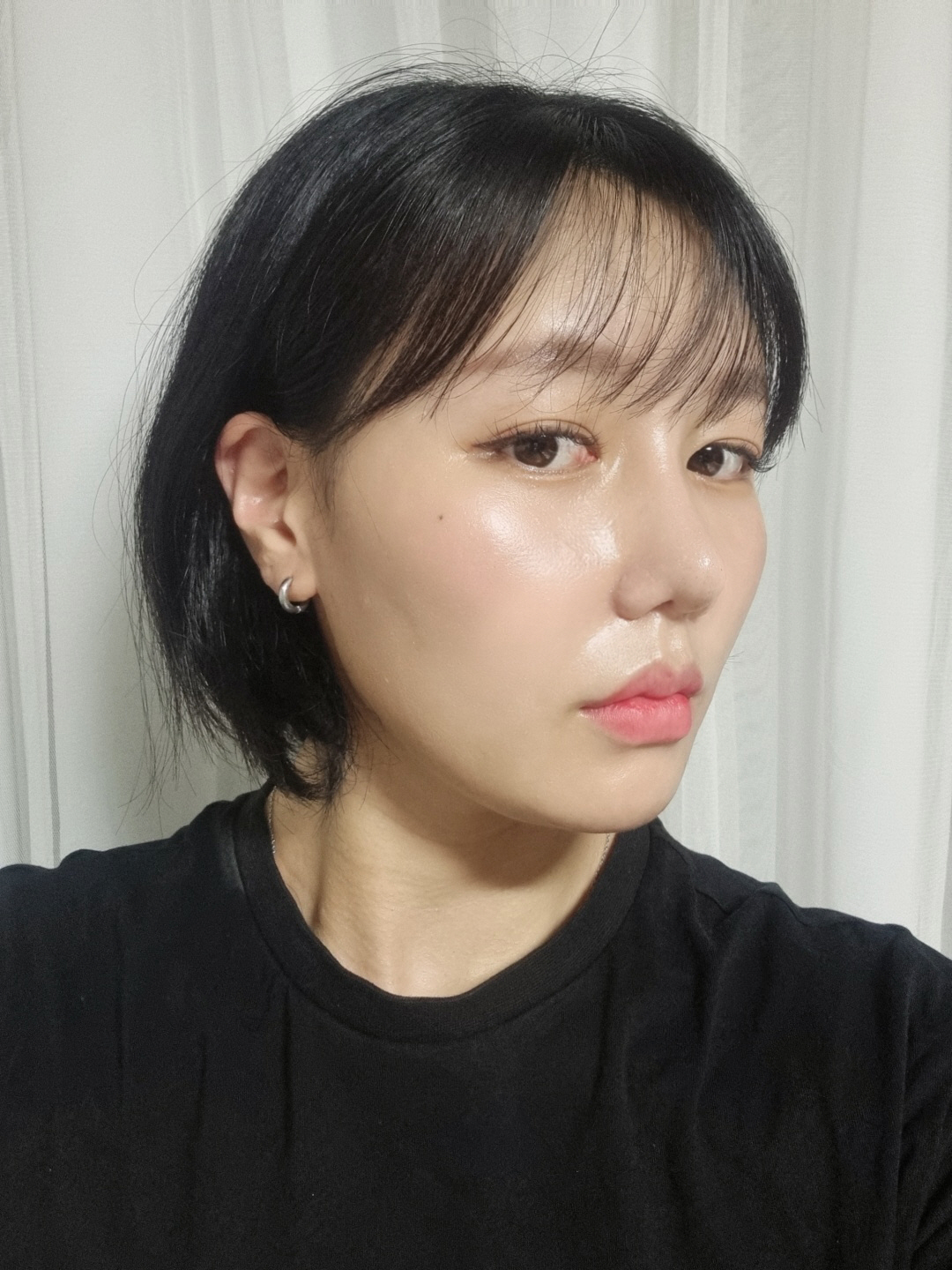 수술후기이미지