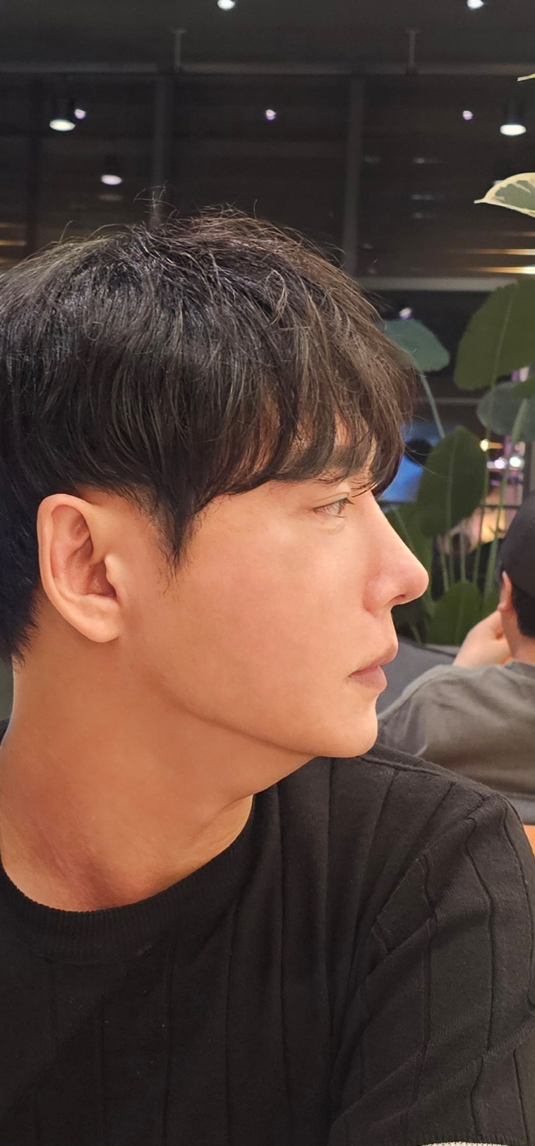 수술후기이미지