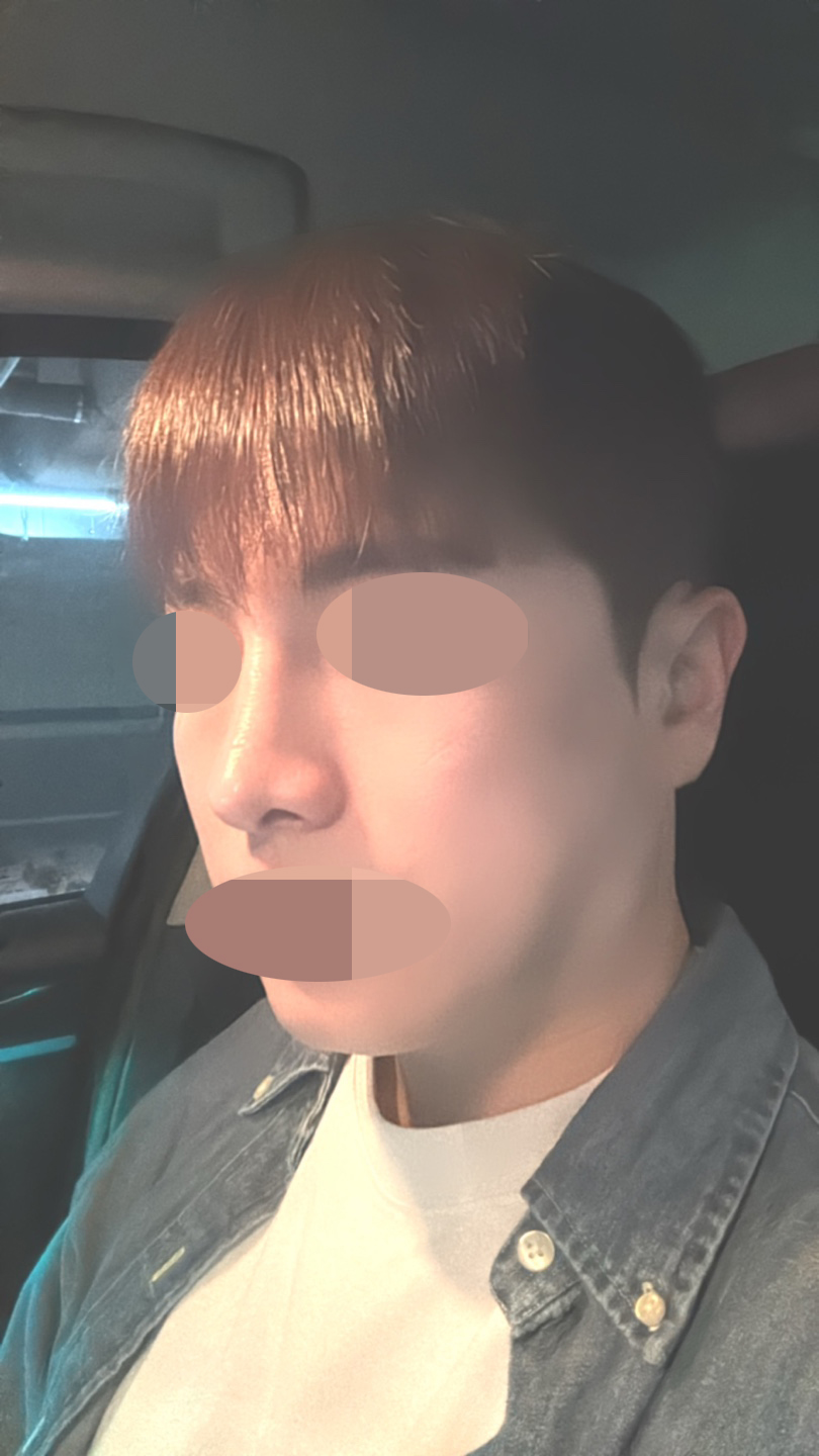 수술후기이미지