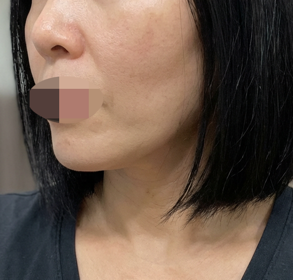 수술후기이미지