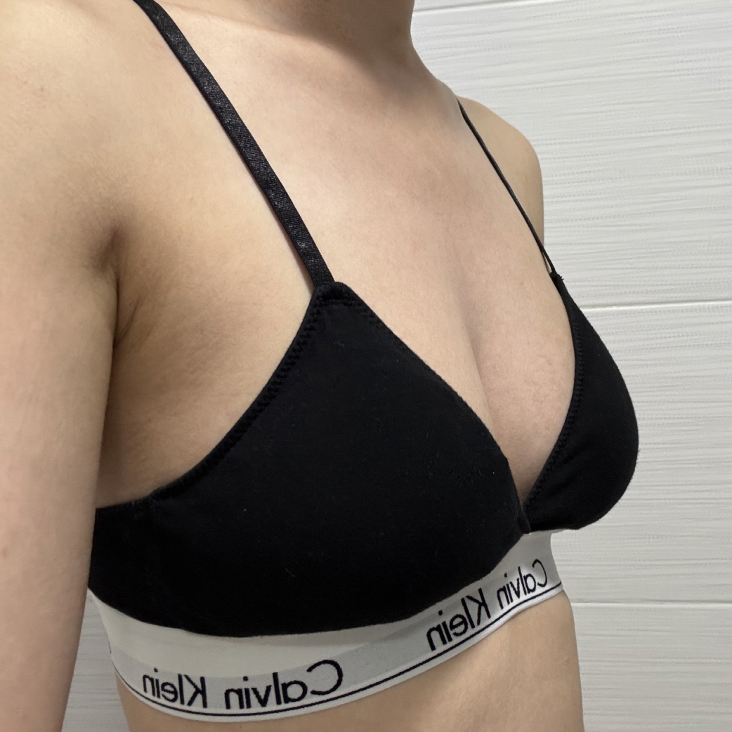 수술후기이미지