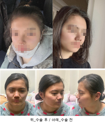 수술후기이미지