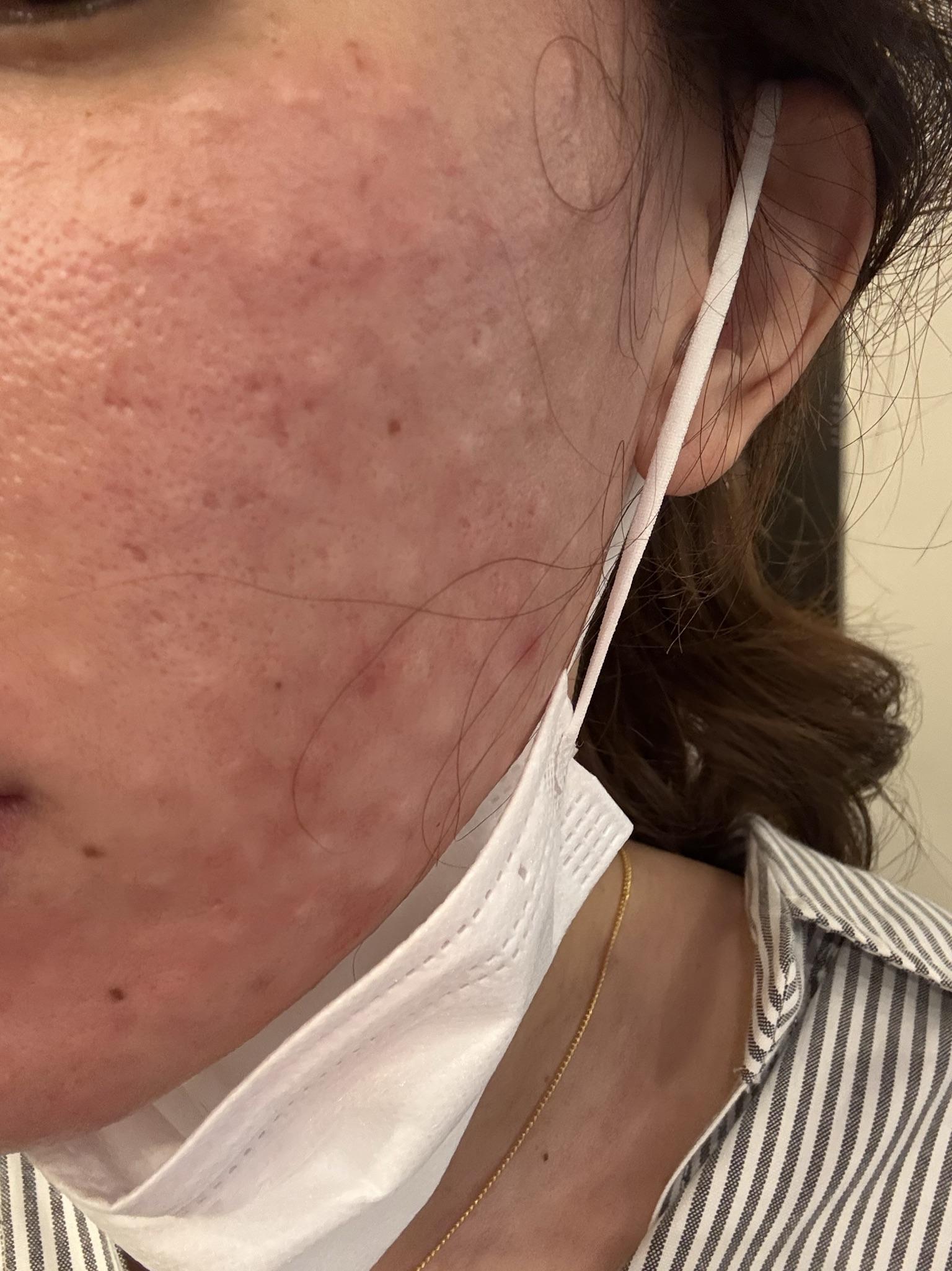 수술후기이미지