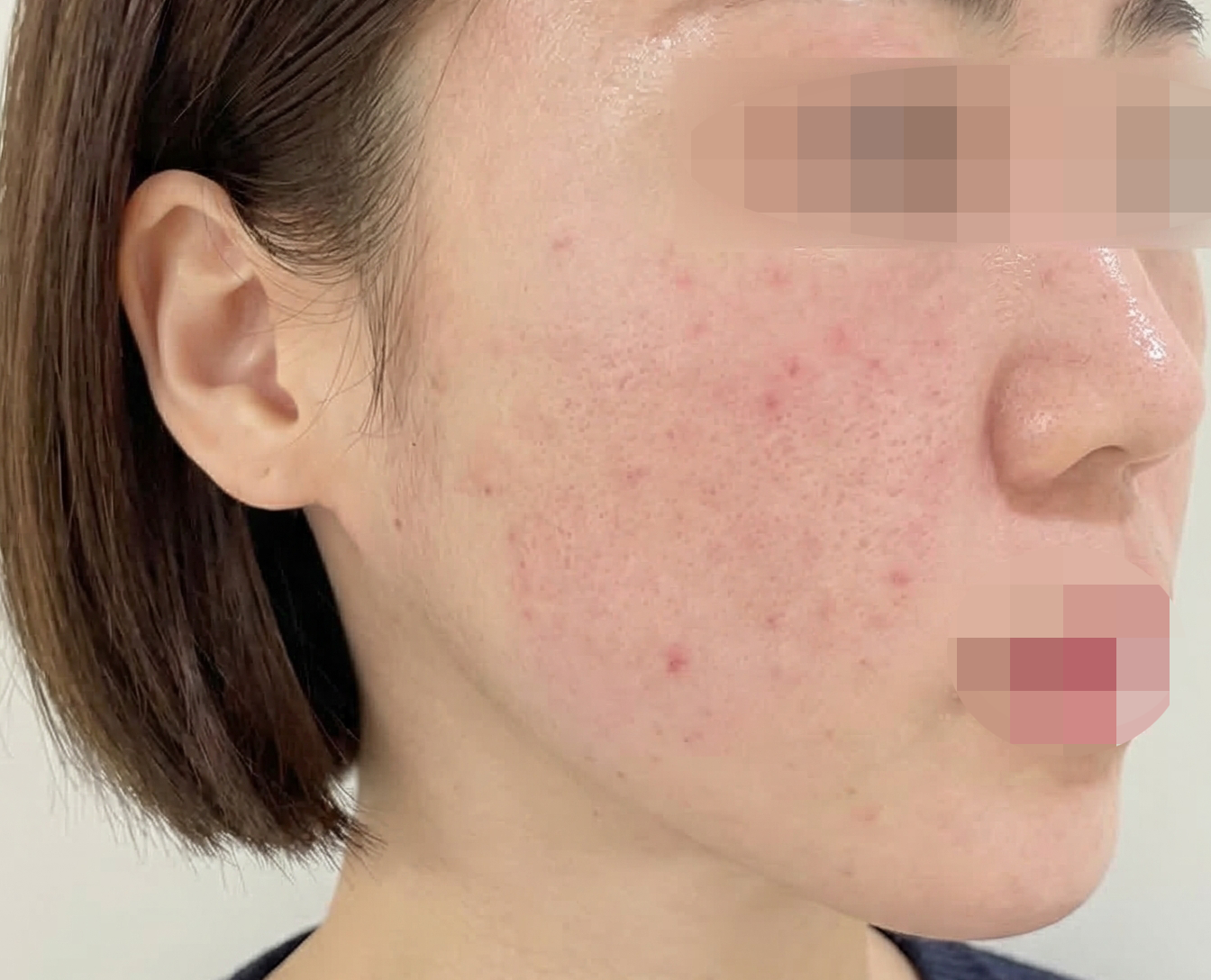 수술후기이미지