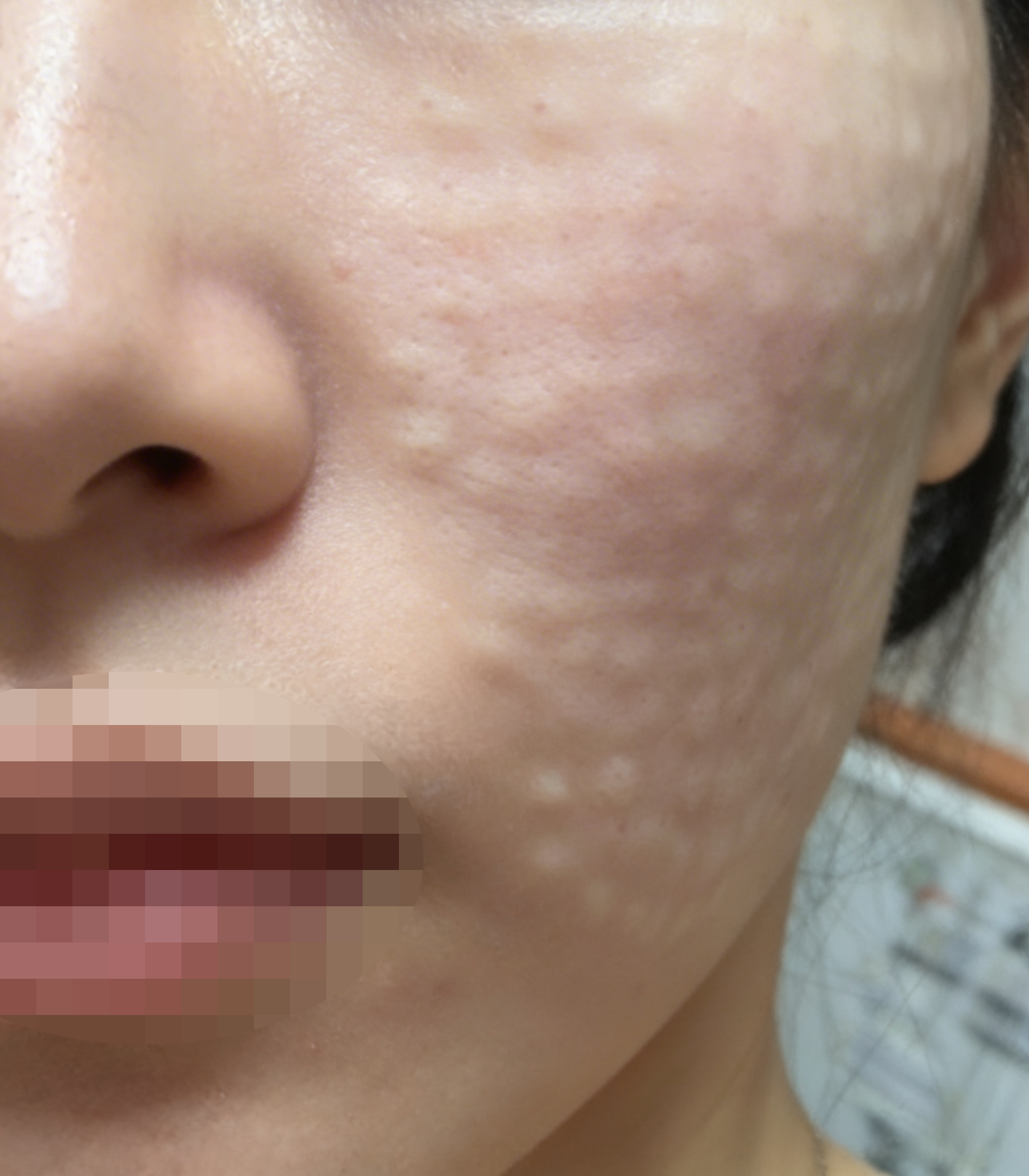 수술후기이미지