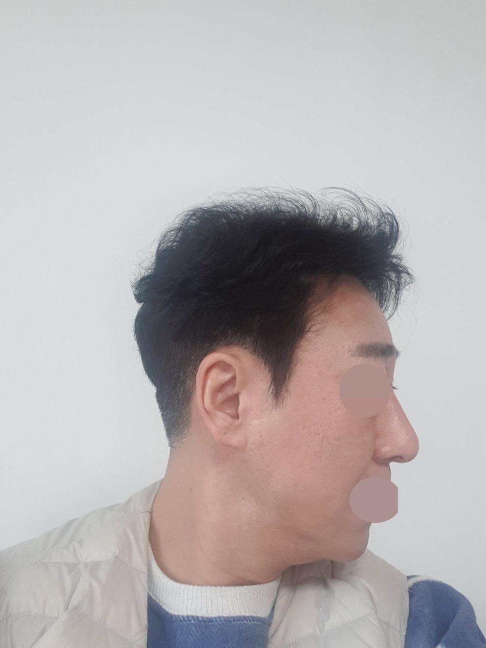 수술후기이미지