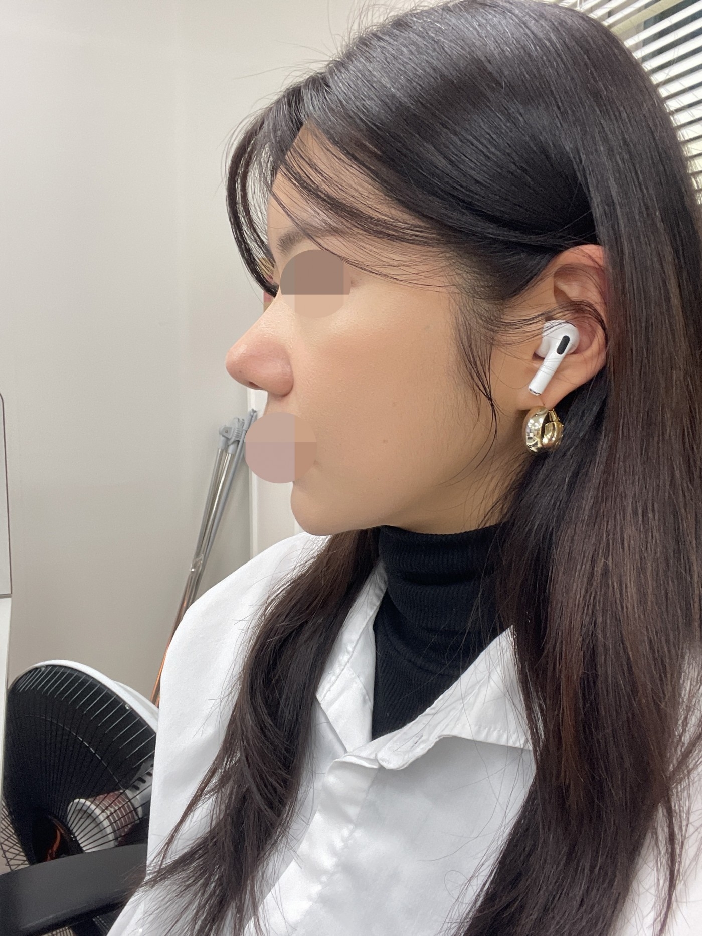 수술후기이미지