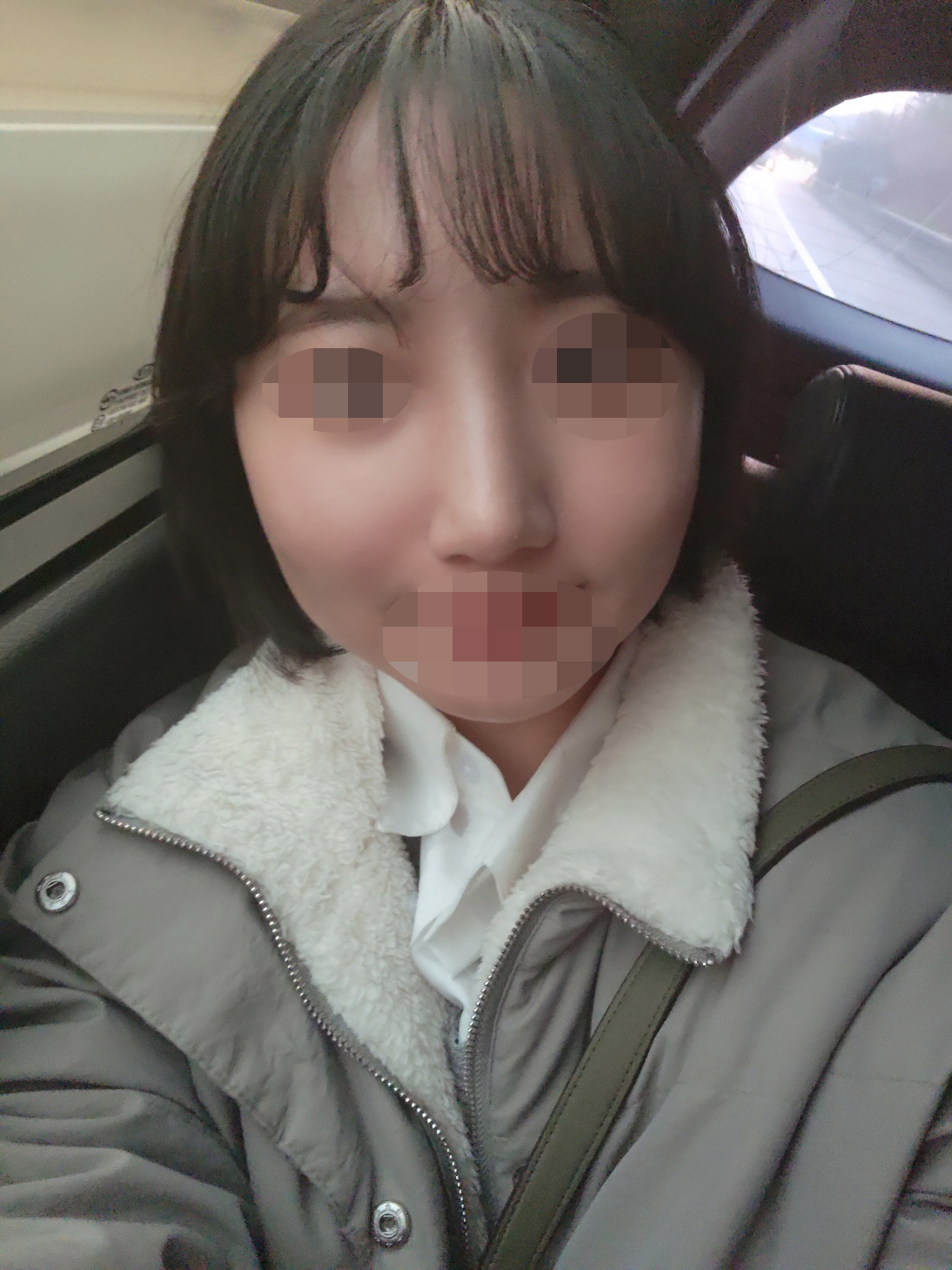 수술후기이미지