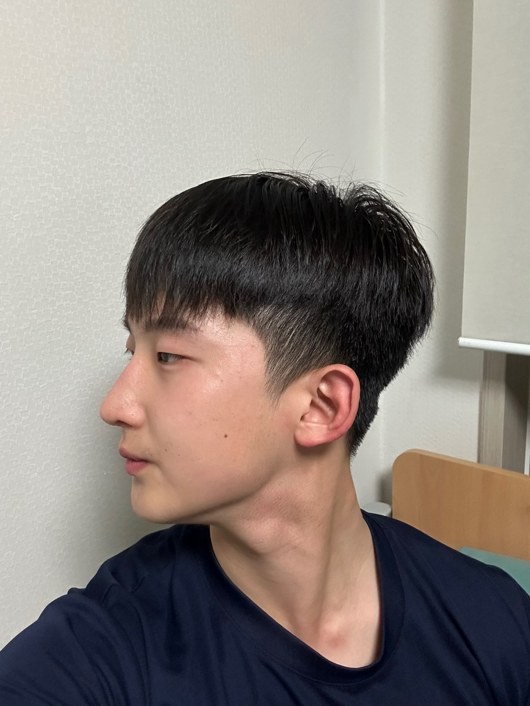 수술후기이미지