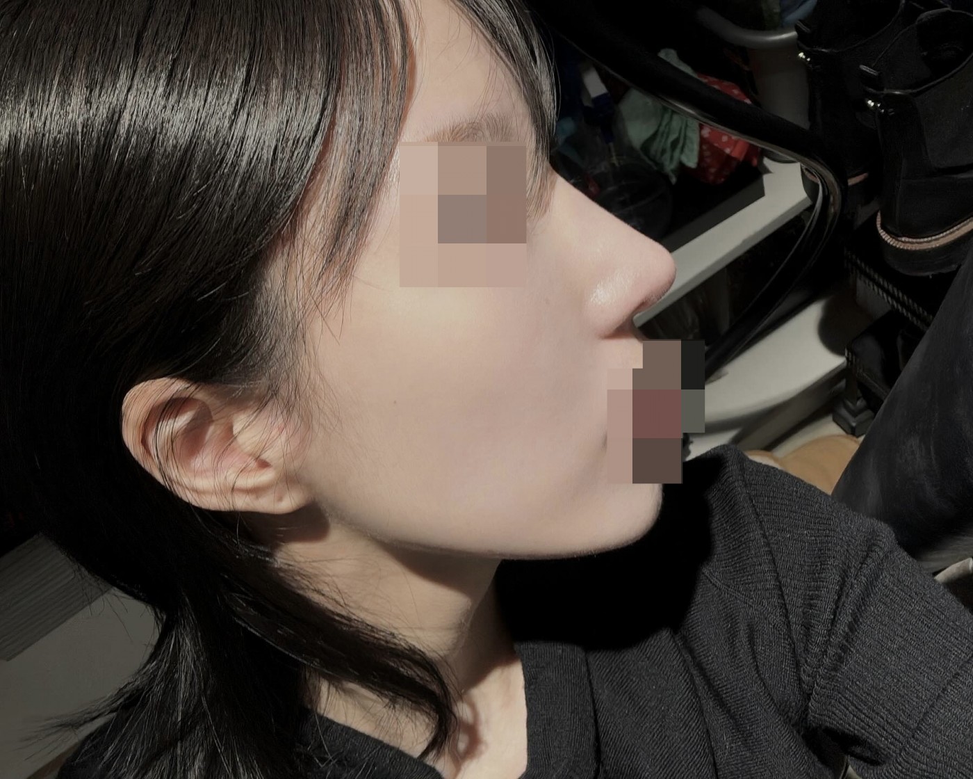 수술후기이미지