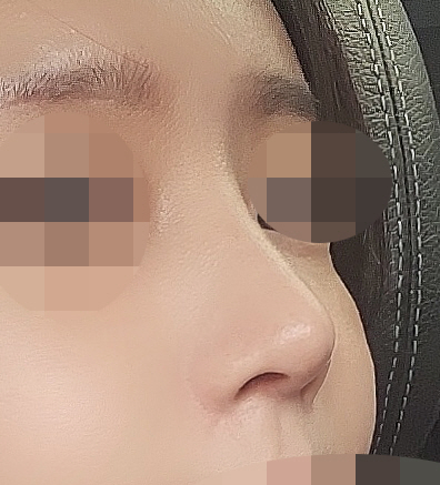 수술후기이미지