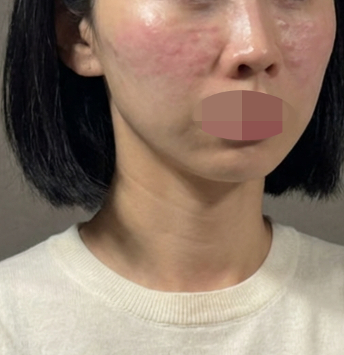 수술후기이미지