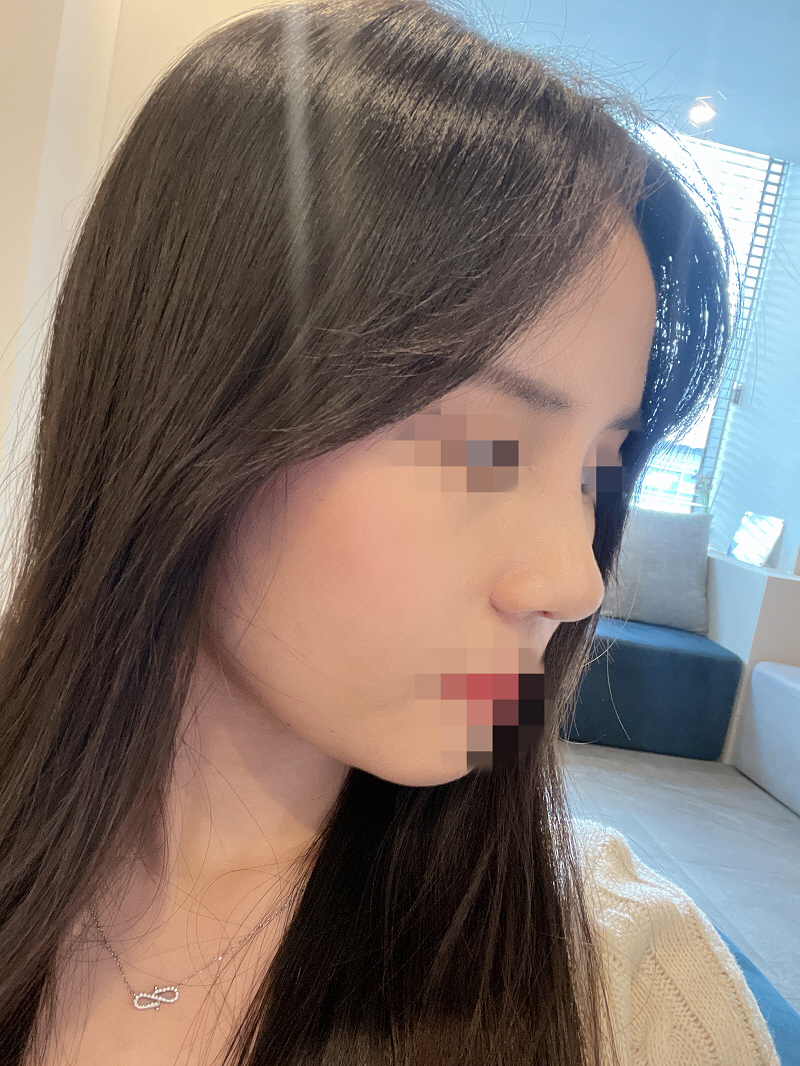 수술후기이미지