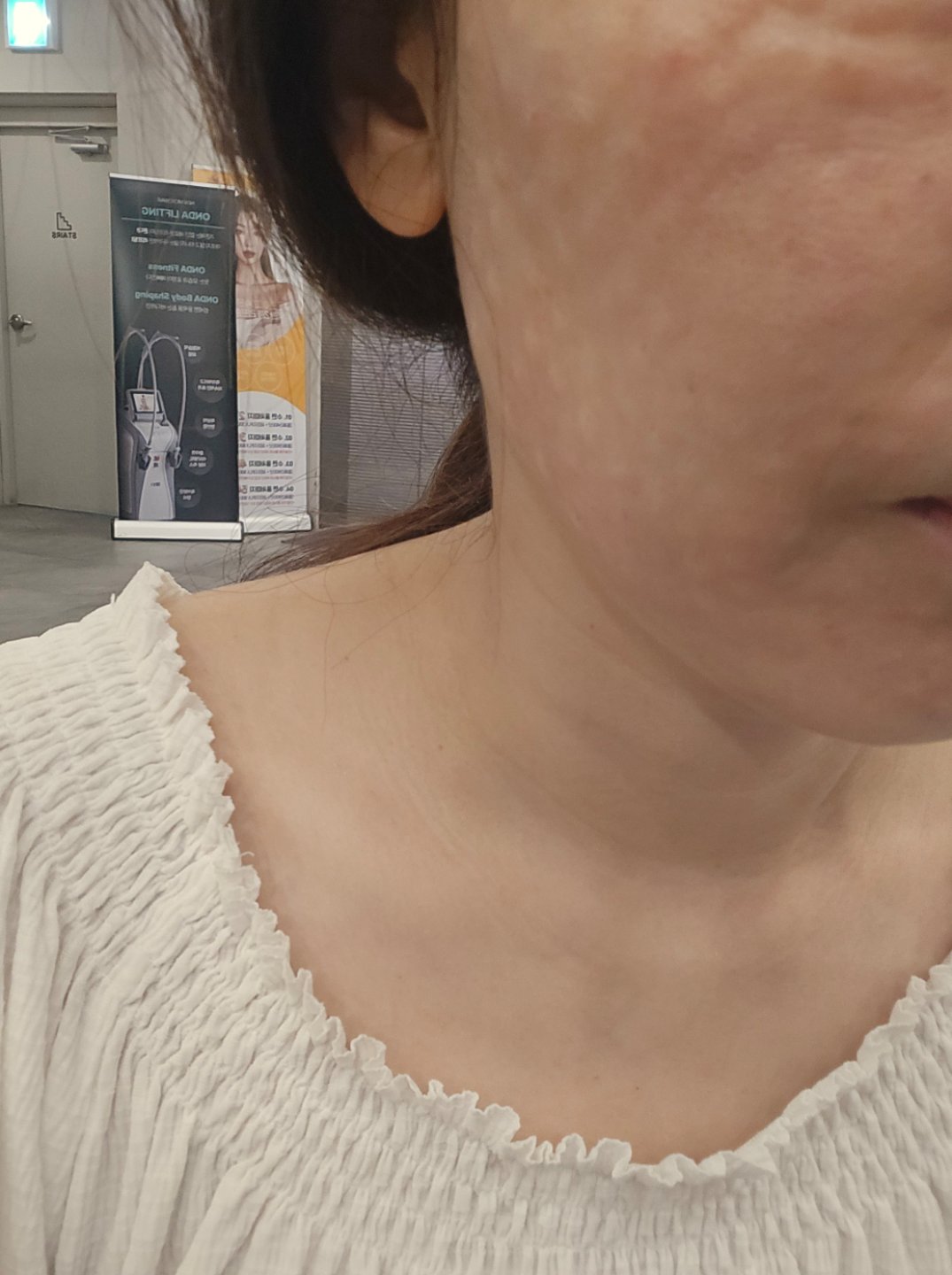 수술후기이미지