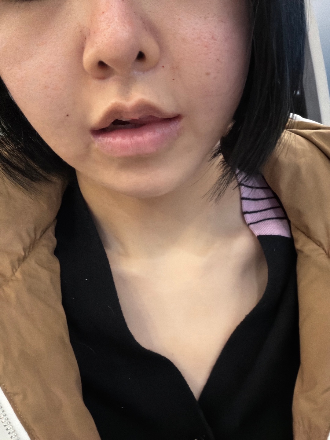 수술후기이미지