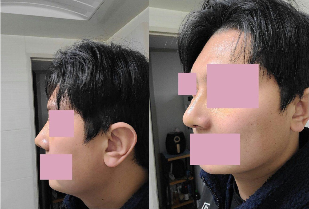 수술후기이미지