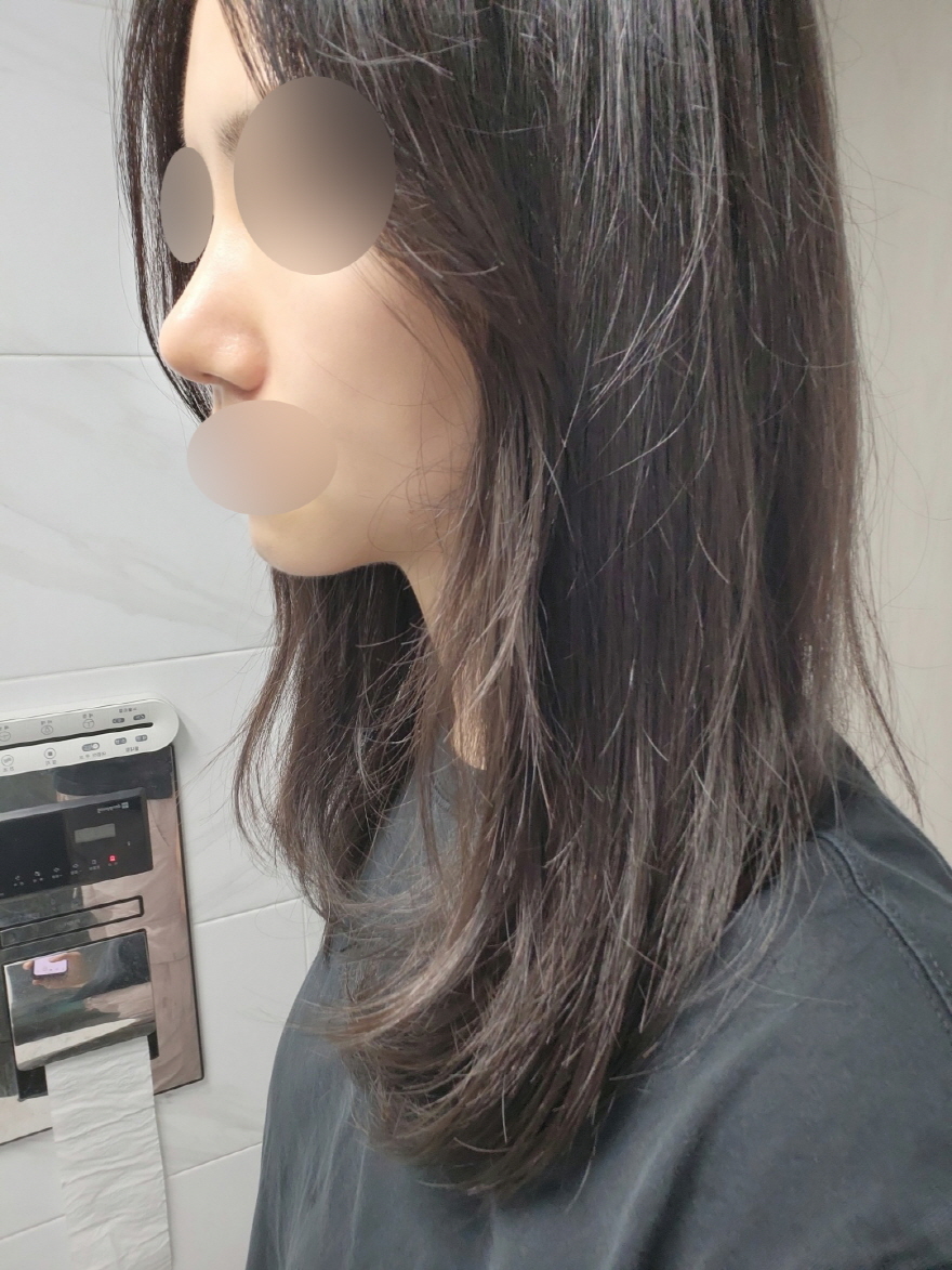 수술후기이미지