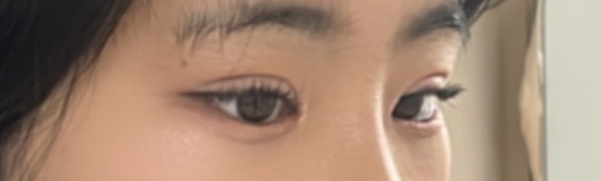 수술후기이미지